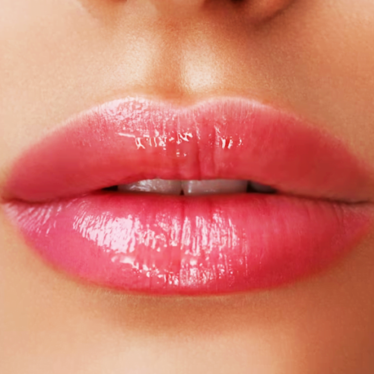 Aumento perfilamiento e hidratación de labios - ácido hialurónico - inyección - Santiago de Cali valle del Cauca Colombia - Clínica de la Belleza Dra Eunice Hernández Ramos 1