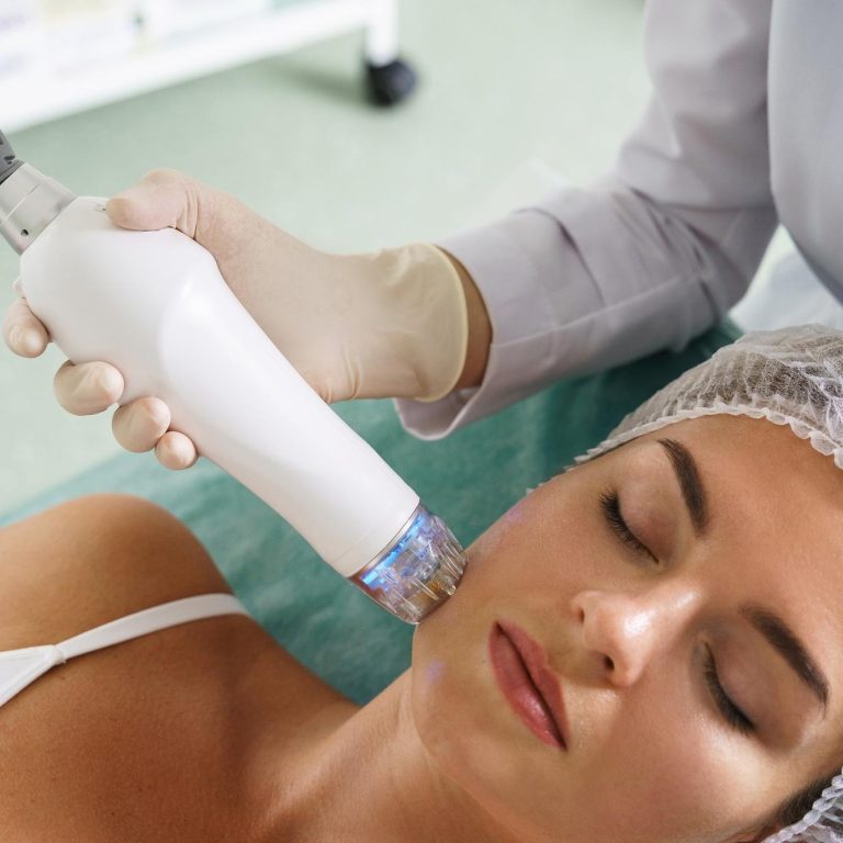 Fixer radiofrecuencia fraccionada microagujas - Clínica de la Belleza by Dra Eunice Hernández - Santiago de Cali Valle de Cauca Colombia 2