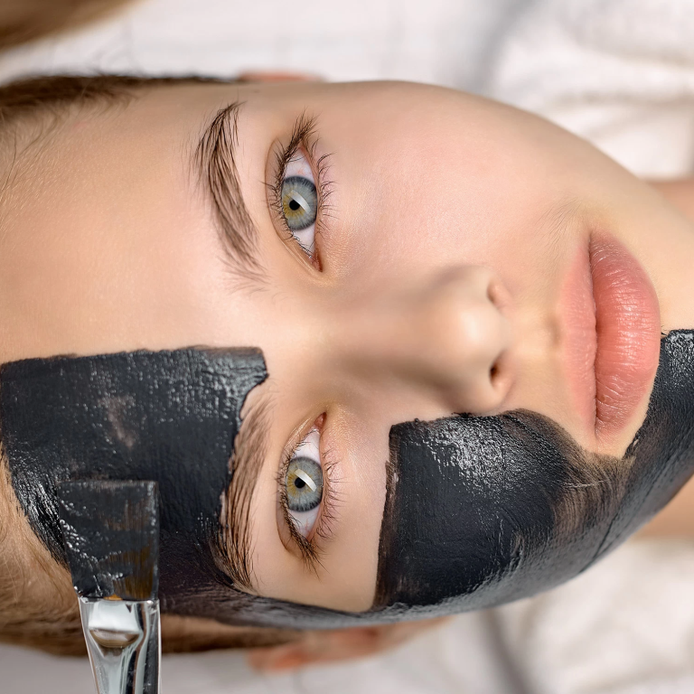 Hollywood peel carbón activo activado mascarilla láser - peeling de las celebridades - piel de porcelana - Clínica de la Belleza - Dra Eunice Hernández 3