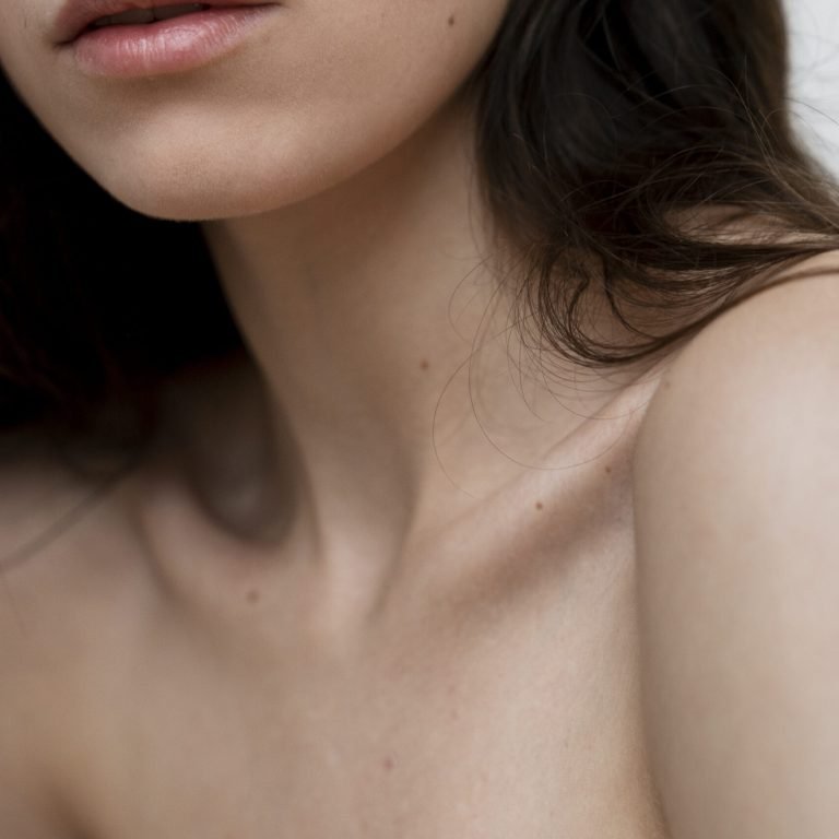 Rejuvenecimiento de cuello y escote - Clínica de la Belleza by Dra Eunice Hernández - Santiago de Cali Valle de Cauca Colombia 1