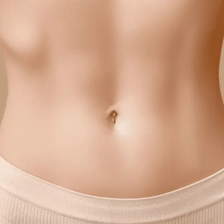 lipo lifting de abdomen - tratamiento Santiago de Cali Valle del Cauca Colombia - Clínica de la Belleza by Dra Eunice Hernández 2